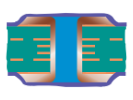 Via riempita e coperta Tipo VI-b PCB bifacciale riempito e coperto