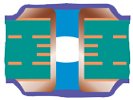 Inserita e coperta Via Tipo IV-b Inserita e coperta - PCB a doppia faccia